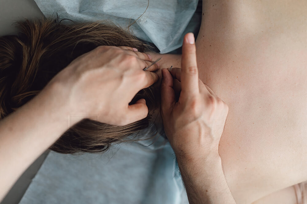 The pros and cons of dry needling