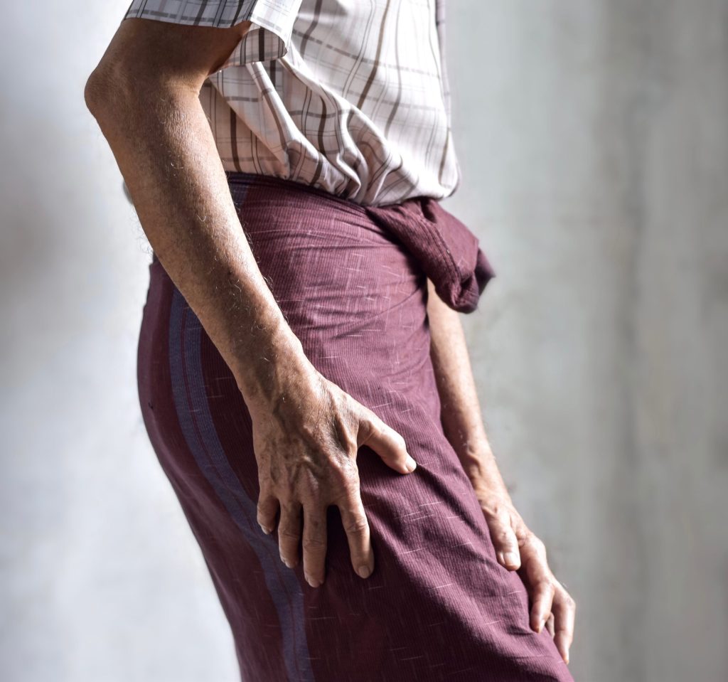 What Would I Do At Physical Therapy With Sciatica? AdobeStock 518038367 scaled 1 what would i do at physical therapy with sciatica?